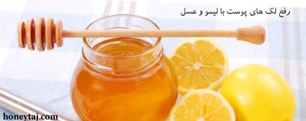 رفع لک های پوست با لیمو و عسل